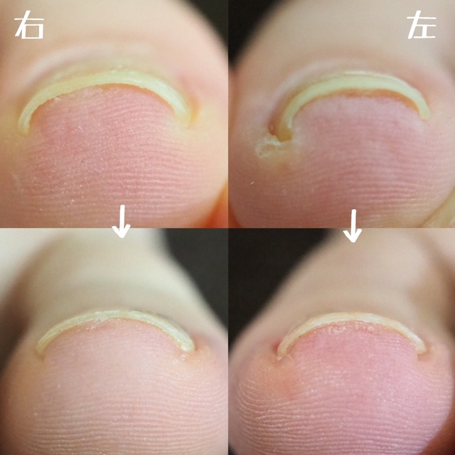 Belta Nail 備前西市のネイルサロン ネイルブック