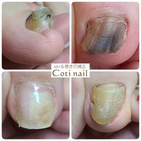 お悩み相談室 Coti Nail コチネイル 府中のネイルサロン ネイルブック