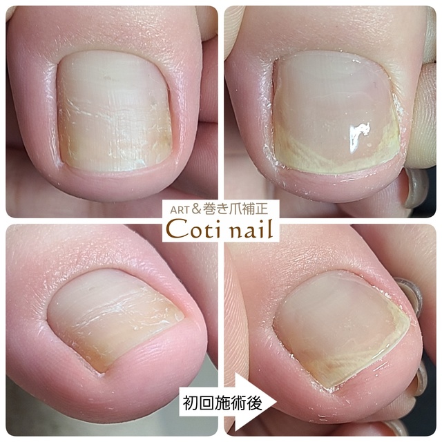 お悩み相談室 Coti Nail コチネイル 府中のネイルサロン ネイルブック